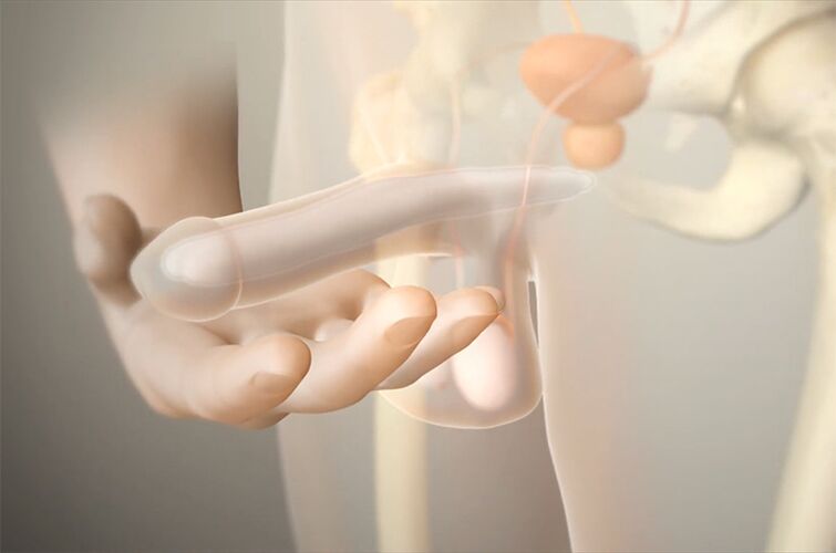 Gel systems to increase a member