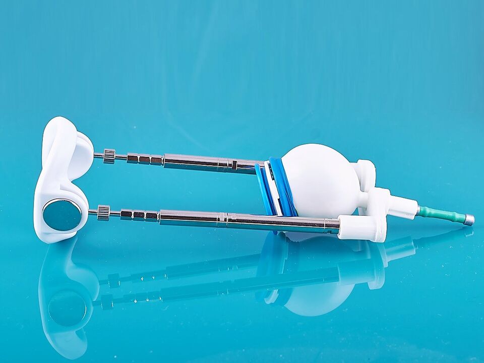 The extensor will help improve the result of the ligamentotomy